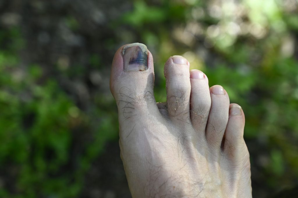 como-cuidar-tus-pies-durante-el-verano-en-barcelona