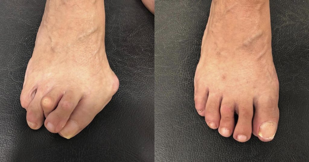 que-novedades-hay-en-el-cuidado-podologico-en-barcelona