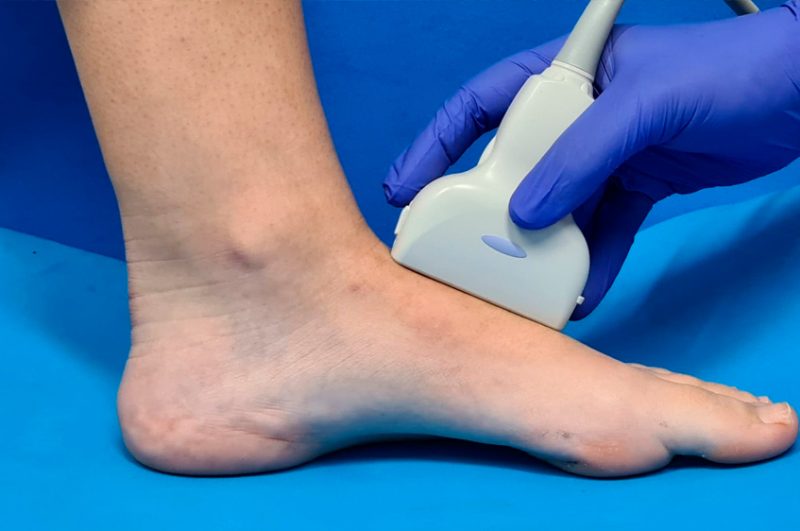 tratamientos-mas-demandados-de-podologia-en-barcelona